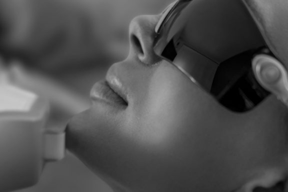 IPL ošetření IPL ošetření